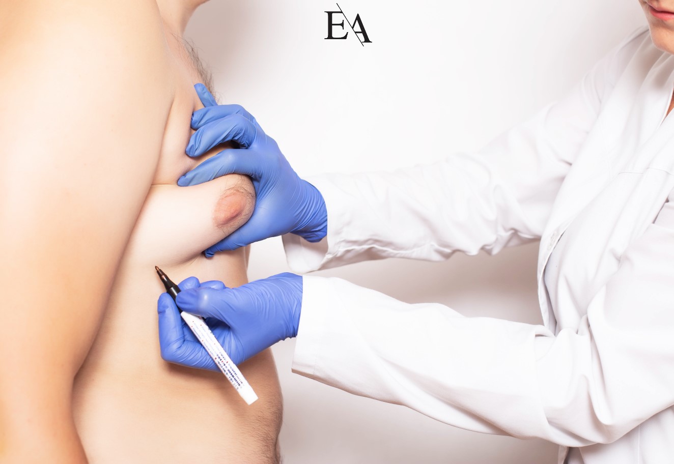 Plastik cerrah ameliyat planlaması