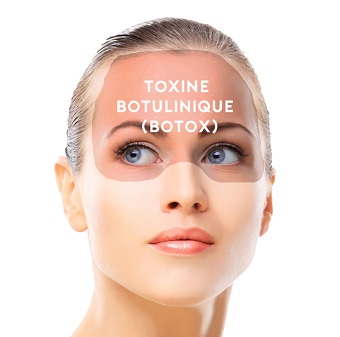 Botox Uygulaması